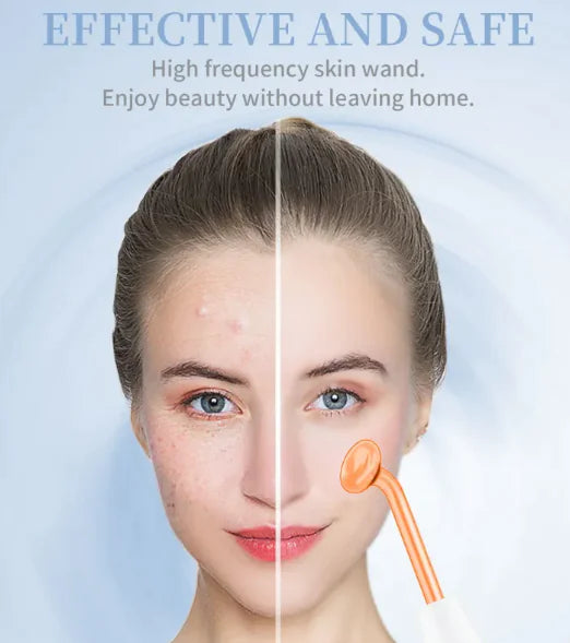 High-Frequency Facial Beauty Device